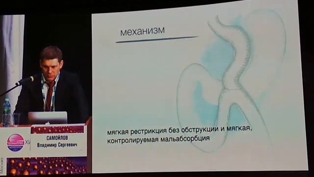 Минижелудочное шунтирование смотреть онлайн