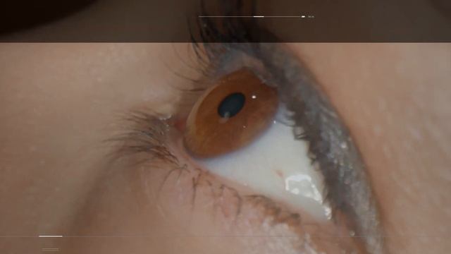 Корнерегель – глазной гель для лечения повреждений роговицы. смотреть онлайн