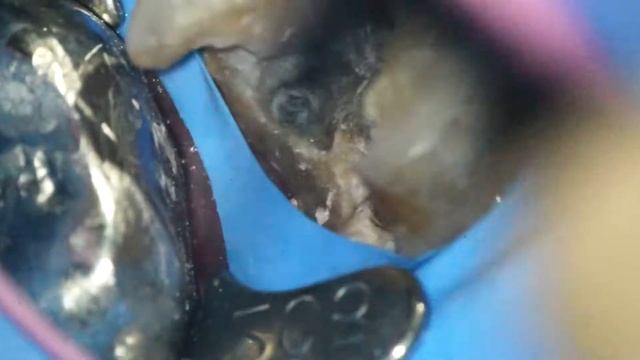 26 DB broken instrument смотреть онлайн