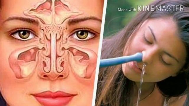 معجزات سبيرولينا😉وأسرار إنقاص الوزن بسبيرولينا😲 смотреть онлайн