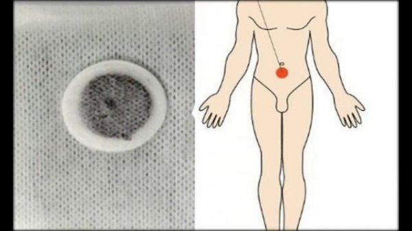 пластыри zb prostatic navel plaster купить