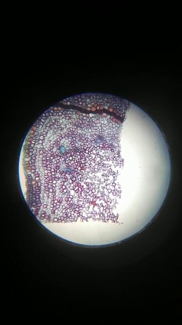 Parenchyma aerenchyma смотреть онлайн