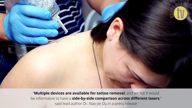 New study shows 1,064 nm lasers most effective for tattoo removal Final смотреть онлайн