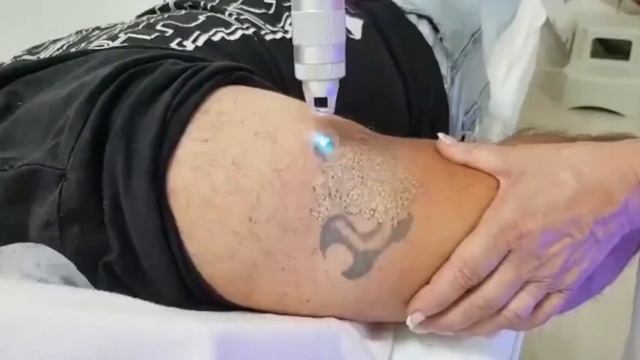deLux kosmetik Blansko - Odstranění tetování смотреть онлайн