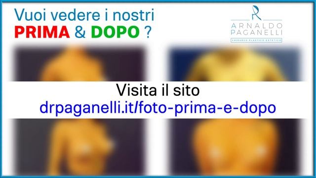 SENO PERFETTO è possibile ottenerlo ? смотреть онлайн