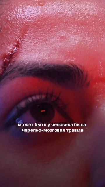 Диагностика причин лишнего веса #лишнийвес #лишнийжир #какпохудеть #похудение #похудеть #психология смотреть онлайн