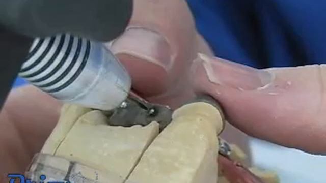 Orion Dental Welders - Basic Welding смотреть онлайн