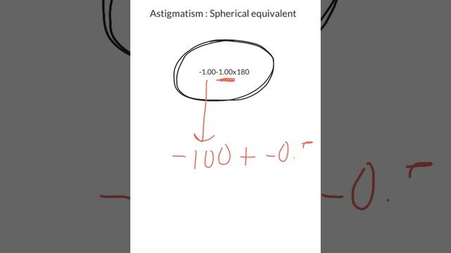 Astigmatism and Spherical equivalent. смотреть онлайн