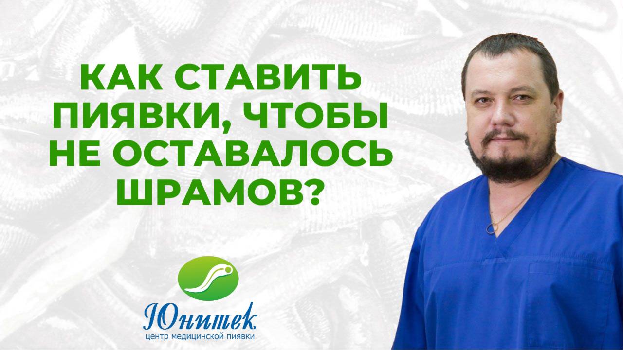 Как ставить пиявки, чтобы не оставалось шрамов?