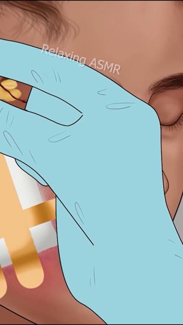 ASMR Effective Scar Treatment #2 смотреть онлайн