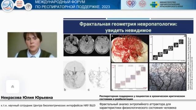Фрактальный анализ состояния человека Некрасова Ю.Ю. 2023