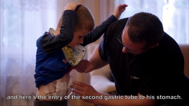 Społeczny aspekt złożonych allotransplantacji w regionie głowy i szyi | Prof. Adam Maciejewski смотреть онлайн
