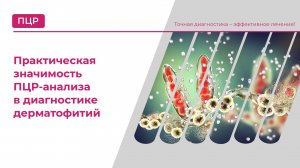 Практическая значимость ПЦР-анализа в диагностике дерматофитий