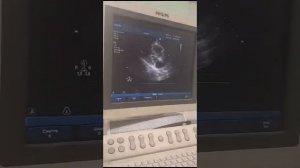 Аккредитация УЗИ ЭХО