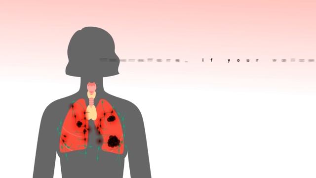 Top 10 Early Warning Signs Of Lung Cancer | NEVER IGNORE THIS