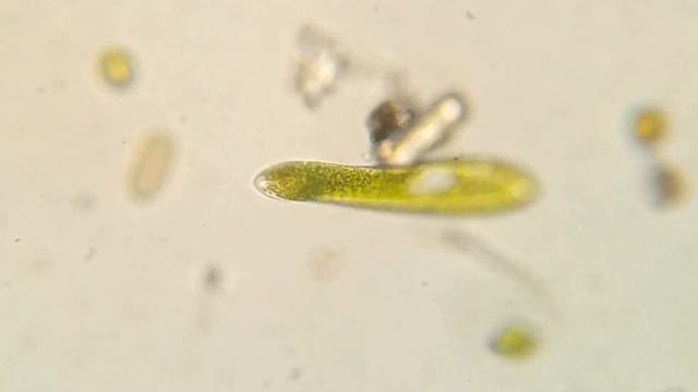 Euglenofitas - (Microscopic life Euglena Phacus Trachelomonas) Humedal La Conejera Bogota смотреть онлайн