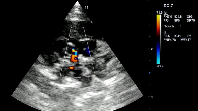 201610011007091018ABD смотреть онлайн