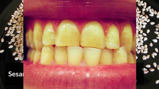 5 Best Home Remedies To Remove Calculus On Teeth | Tartar In Teeth | Tartar & Plaque Removal At Hom смотреть онлайн