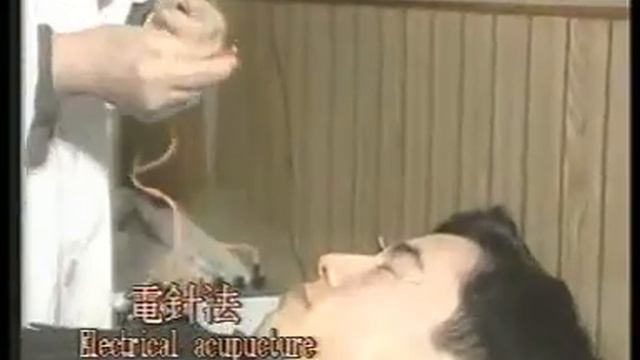 23 眼针疗法 道│Taoism смотреть онлайн