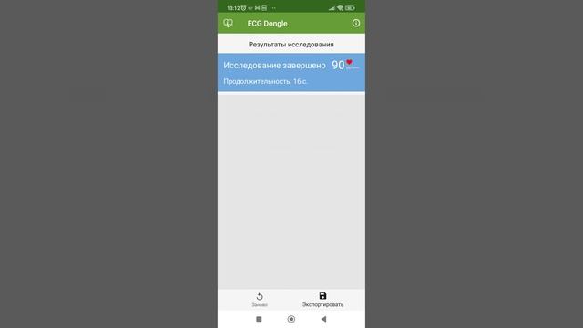 Отправка ЭКГ персональному врачу смотреть онлайн