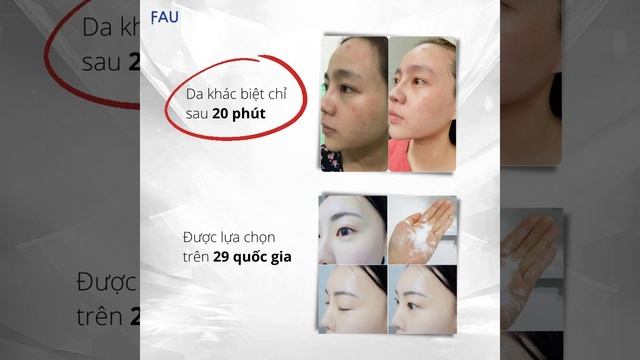FAU | Combo 𝐒𝐩𝐨𝐭𝐥𝐢𝐠𝐡𝐭 𝐖𝐡𝐢𝐭𝐞𝐧𝐢𝐧𝐠 giúp da sáng bật tone, hợp cạ mọi làn da kể cả da nhạy cảm смотреть онлайн