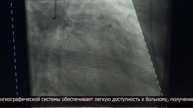 Новые медицинские возможности: в областном кардиоцентре приобрели аппарат «Azurion 7» смотреть онлайн
