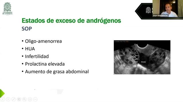 Exceso de andrógeno смотреть онлайн