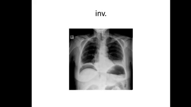 Peritoneum - English dubbed - Dr. Mohammad Algazar смотреть онлайн