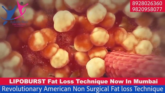 Best Weight Loss In Centre In Mumbai || LIPO BURST Weight Loss Clinic In Mumbai || Slimming Centre смотреть онлайн