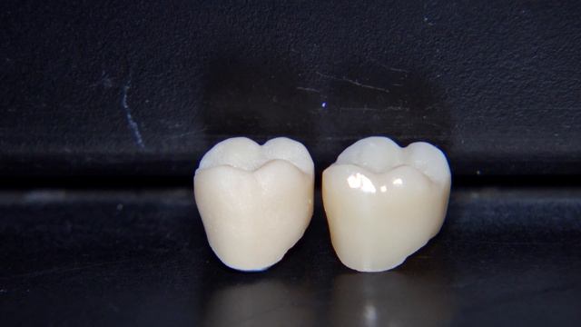 CEREC Tessera Spray and Glaze DE смотреть онлайн