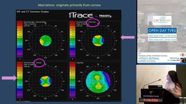 P. Kalouda | Beyond myopia and astigmatism. Explaining why some patients don’t reach the 10/10 be.. смотреть онлайн