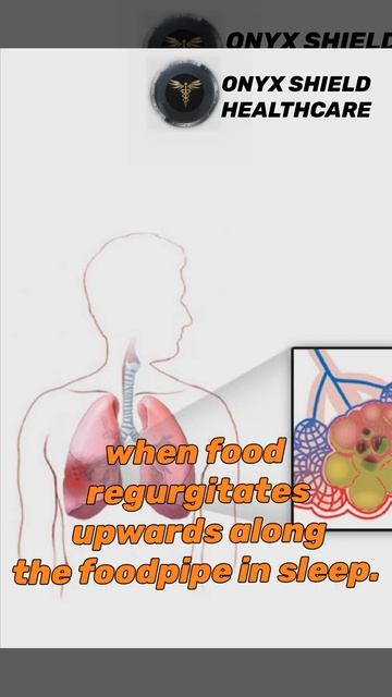 ASPIRATION PNEUMONITIS - A QUICK OVERVIEW смотреть онлайн
