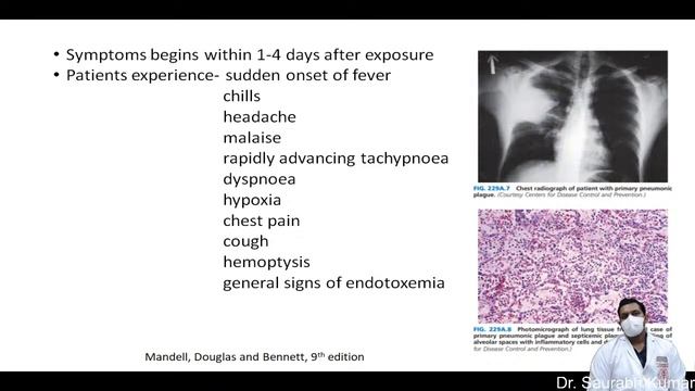 plague- an emerging infection of 21st century смотреть онлайн