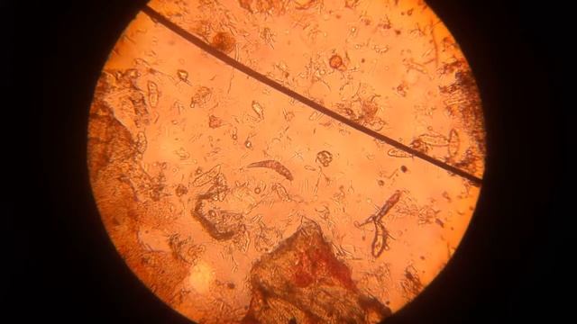 Demodex canis смотреть онлайн
