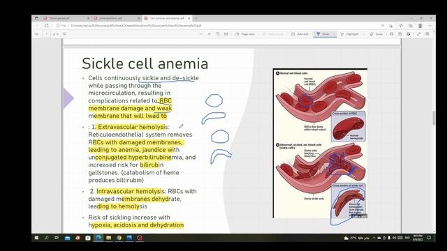 2-Iron turn over, Anemia and polycythemia смотреть онлайн