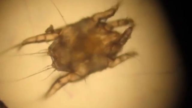 Otodectes cynotis al microscopio смотреть онлайн