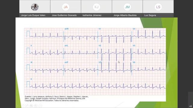 EKG TALLER CASOS ELECTIVA 6 06 2022 смотреть онлайн