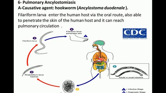 Parasitic Infections of The Lung смотреть онлайн