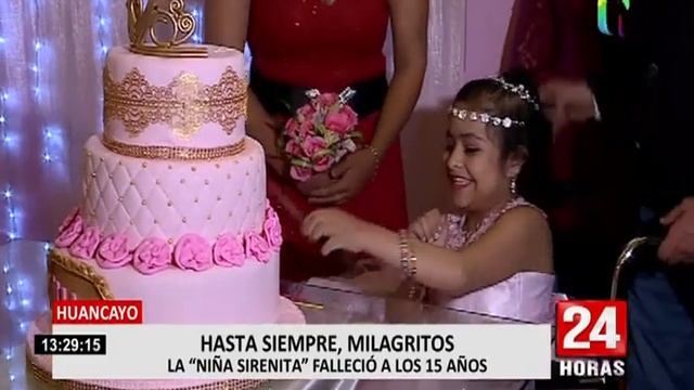 Milagros Cerrón, La 'niña Sirenita' Murió A Los 15 Años En Junín