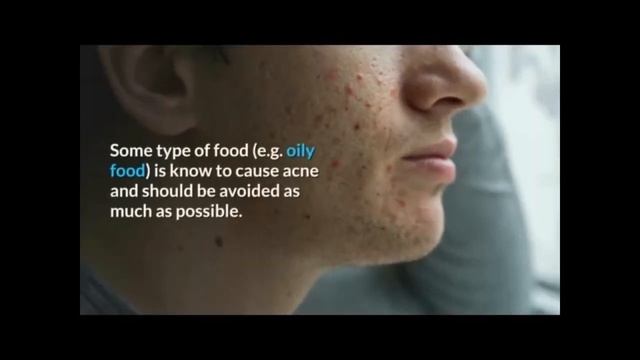 Tom's of Maine Whole Care Natural Toothpaste with Fluoride, Cinnamon Clove, 4 0 oz 3 Pack 6 смотреть онлайн