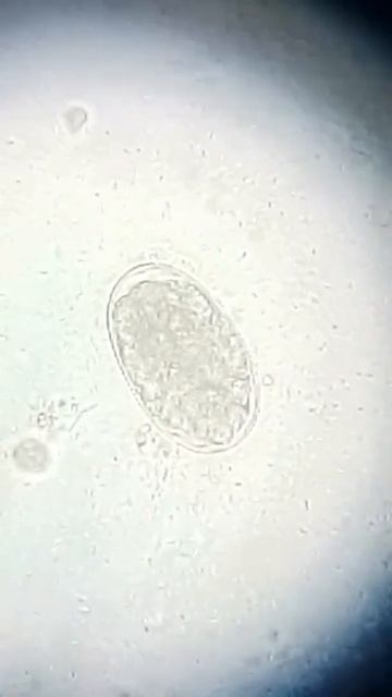 Ancylostoma Canino смотреть онлайн