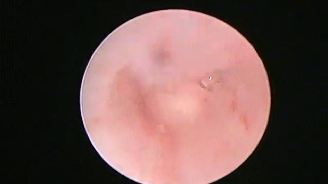 Urethrostomy feline смотреть онлайн