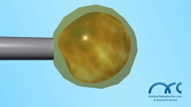 ICSI- 3D.Top IVF centers.Advanced Fertility treatments.Medical Tourism India, Infertility-ARC Centr смотреть онлайн