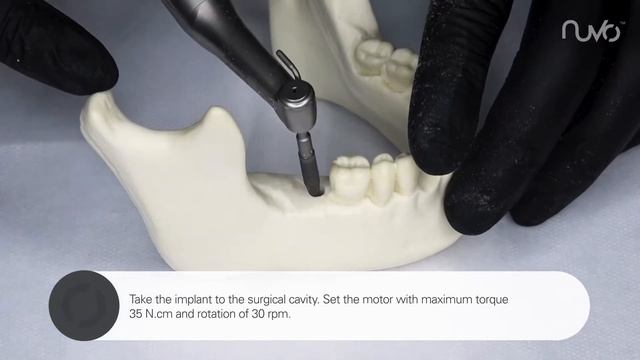 Package Opening - NUVO™ Implant System. смотреть онлайн
