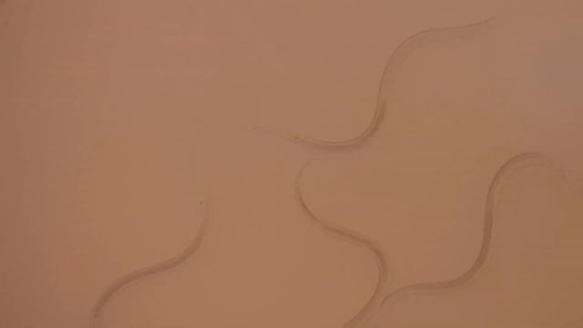 Cultured Human Parasites Microscopy at various magnifications смотреть онлайн