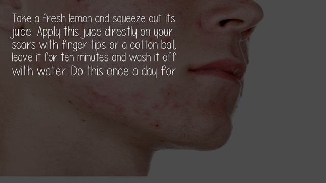 What Is The Best Cream For Acne Scar? смотреть онлайн