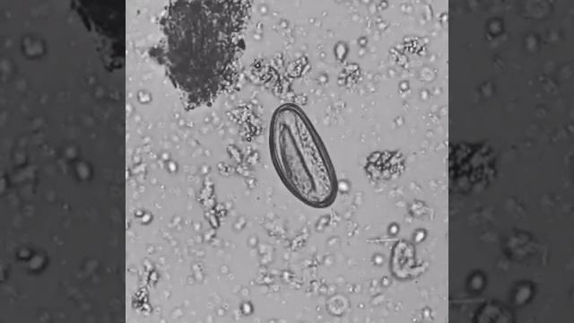 Ovo de Enterobius vermicularis com larva смотреть онлайн