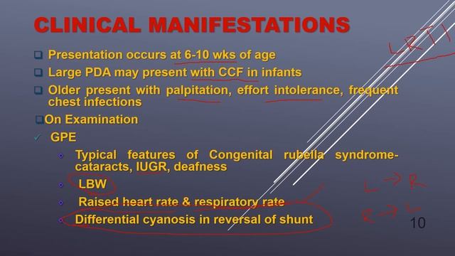 Patent Ductus Arteriosus || PDA || Commonest CHD in Preterm смотреть онлайн
