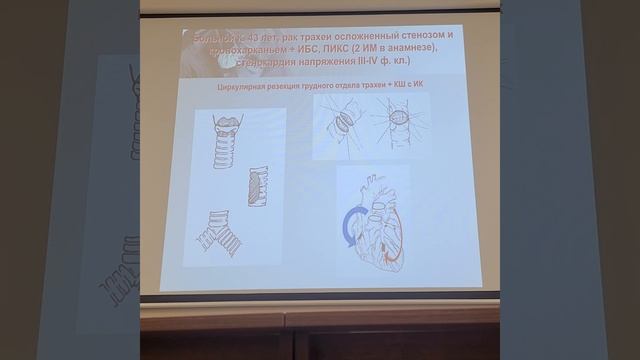 Хирургическое лечение онкобольных с патологией ССС. Герасимов С. С. смотреть онлайн