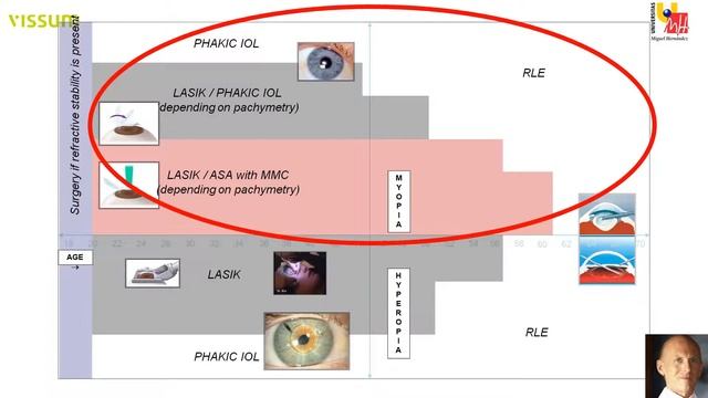 Lens Surgery In High Myopia | J. Alio